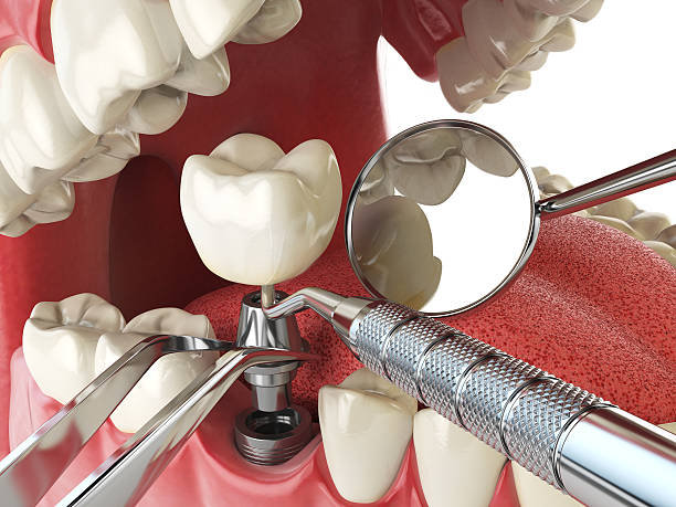 Best Pediatric Emergency Dentist in Lyndon, KY