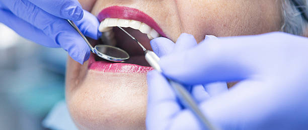 Best Emergency Tooth Extraction in Lyndon, KY