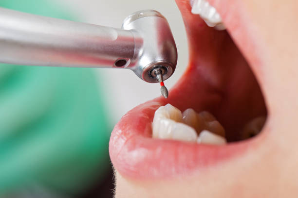 Best Pediatric Emergency Dentist in Lyndon, KY